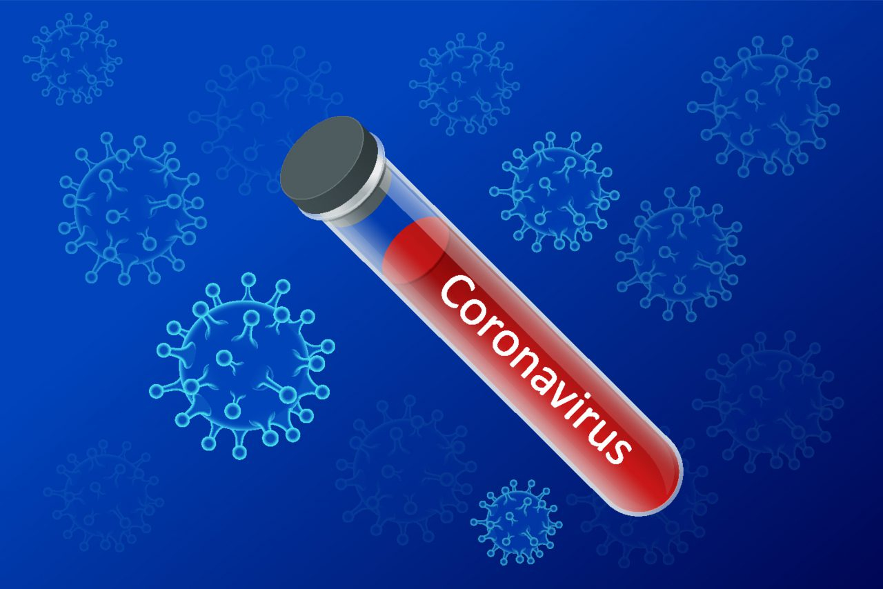 ÜST-dən qorxudan açıqlama: “Koronavirus həmişəlik dünyada qala bilər”