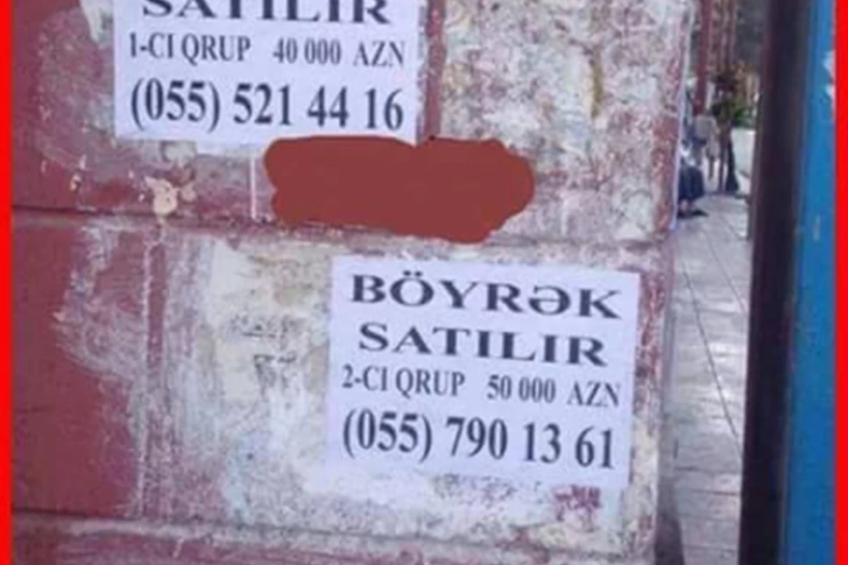 Bakıda açıq şəkildə böyrək satılır: 70 min manat (FOTO)