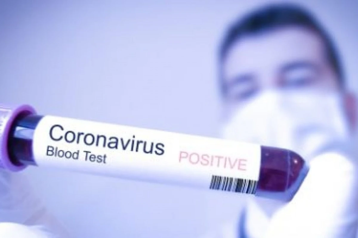 Koronavirus bu temperaturda aktiv qalır