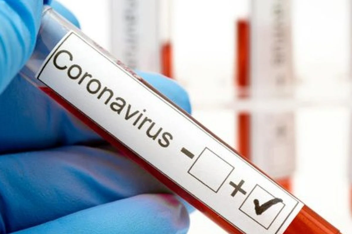 Türkiyədə yeni növ koronavirus infeksiyasından daha 18 nəfər ölüb - VİDEO