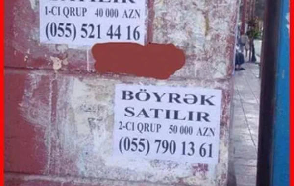 Bakıda açıq şəkildə böyrək satılır: 70 min manat (FOTO)