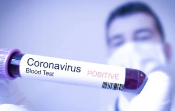 Koronavirus bu temperaturda aktiv qalır