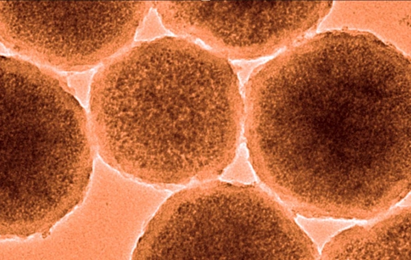 Beyinə qan sızmanı dayandıra bilən nanorobotlar istehsal edilib