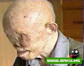Выживший в Хиросиме