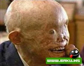 Выживший в Хиросиме