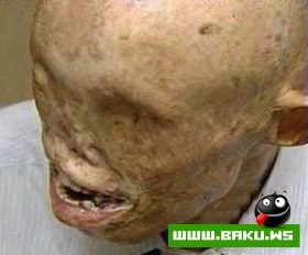 Выживший в Хиросиме