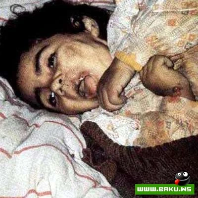 26 fevral 2009-cü il - Xocalı faciəsinin 17-ci ildönümüdür