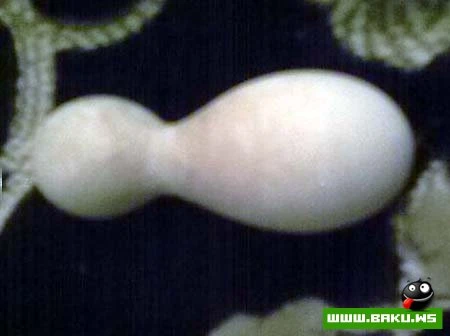 Milli Yumurta :)