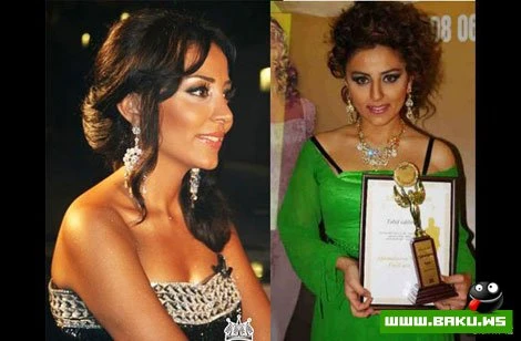 Azərbaycan ulduzları plastik əməliyyatlardan əvvəl və sonra