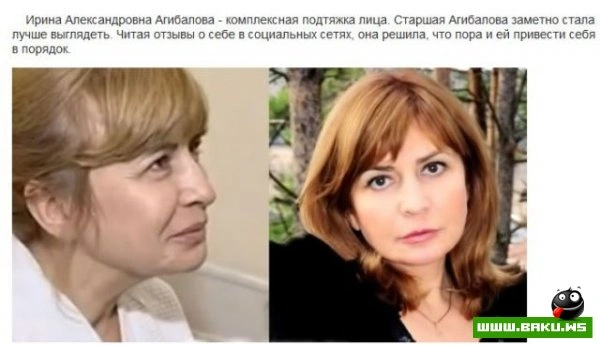 Пластическая хирургия на проекте 
