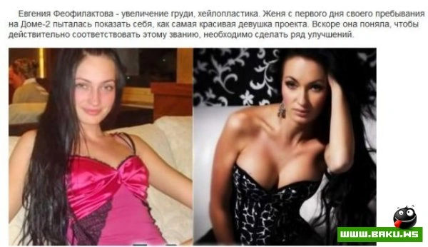 Пластическая хирургия на проекте 