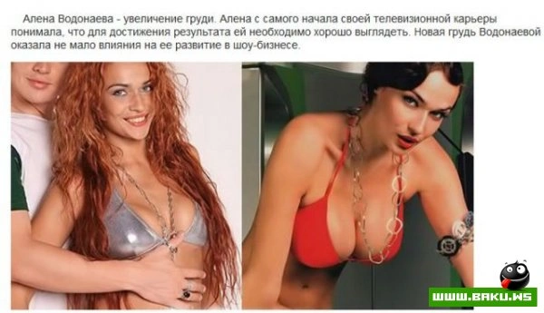 Пластическая хирургия на проекте 