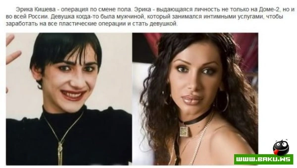 Пластическая хирургия на проекте 