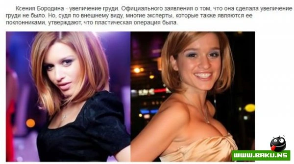 Пластическая хирургия на проекте 