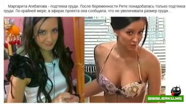 Пластическая хирургия на проекте 