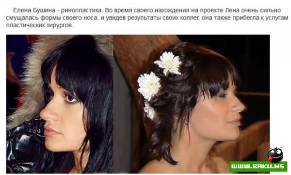 Пластическая хирургия на проекте 