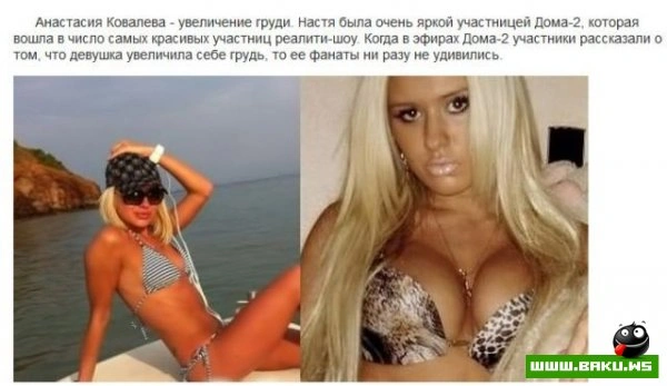 Пластическая хирургия на проекте 