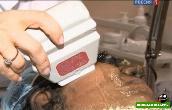 Сестрам-оборотням из Индии помогли российские врачи