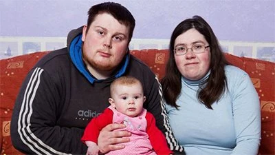 Врачи спасли новорожденную с 3 органами наружу
