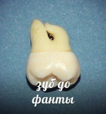 Напитки, которые разрушают наши зубы