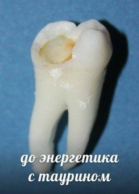 Напитки, которые разрушают наши зубы