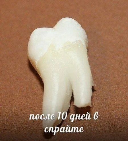 Напитки, которые разрушают наши зубы