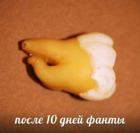 Напитки, которые разрушают наши зубы