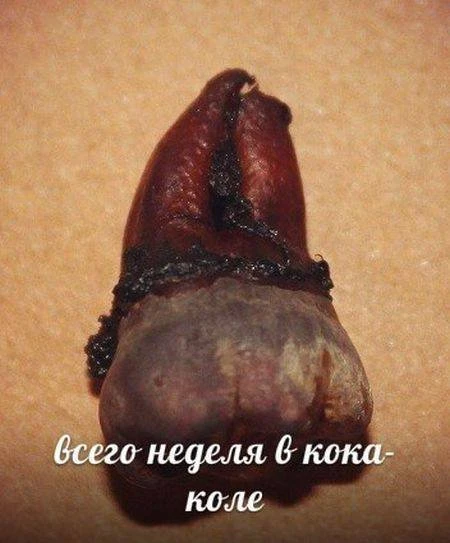 Напитки, которые разрушают наши зубы
