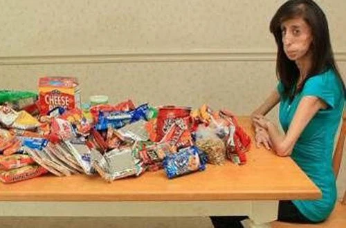 23-летняя девушка весит 27 килограмм