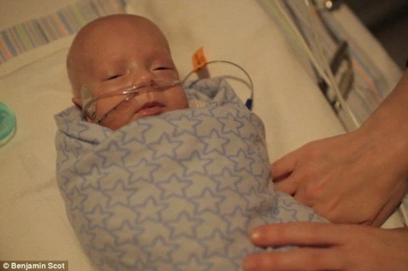 Чудесная история малыша, родившегося на 3,5 месяца раньше срока