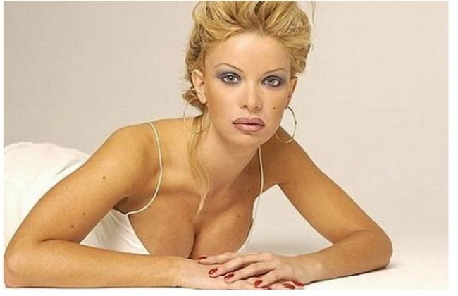 Алисия Дюваль пережила 100 пластических операций