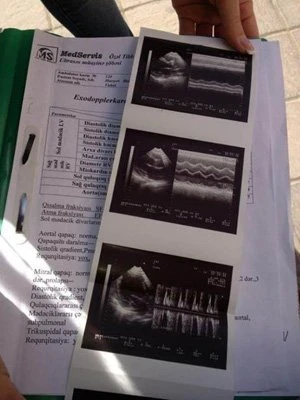 12-летнему Мураду Гаджиеву срочно нужна помощь!