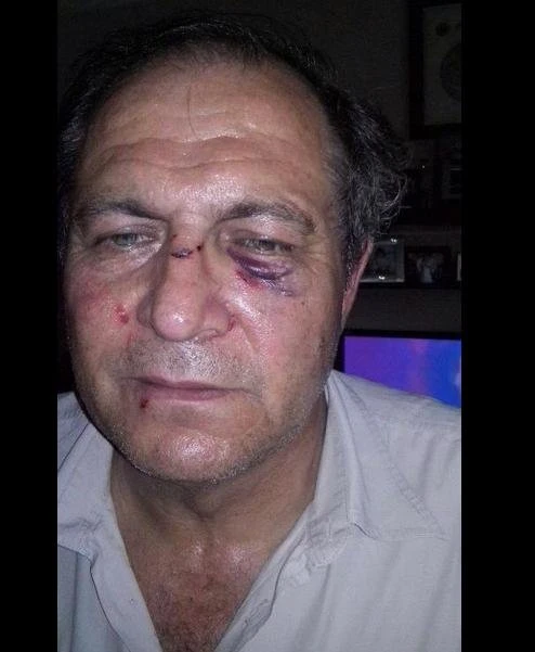 В Азербайджане женщина с братьями напала на семью бывшего мужа