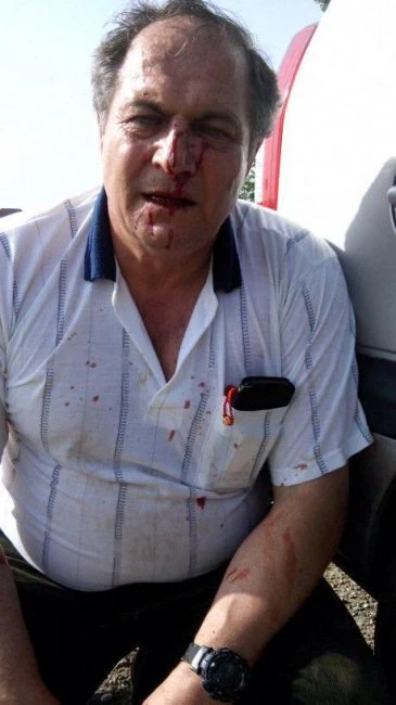 В Азербайджане женщина с братьями напала на семью бывшего мужа