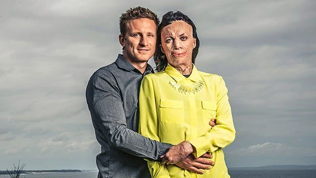 Женщина, выжившая после лесного пожара, на обложке журнала Australian Women’s Weekly