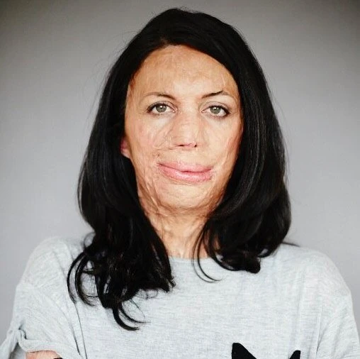Женщина, выжившая после лесного пожара, на обложке журнала Australian Women’s Weekly