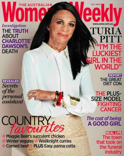 Женщина, выжившая после лесного пожара, на обложке журнала Australian Women’s Weekly