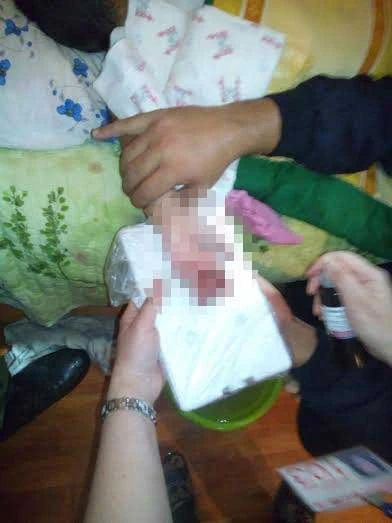 В Баку рука 2-летнего ребенка попала в мясорубку