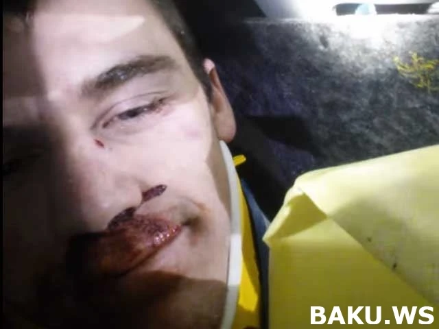 Видео-селфи из разбитой машины взрывает интернет (видео)
