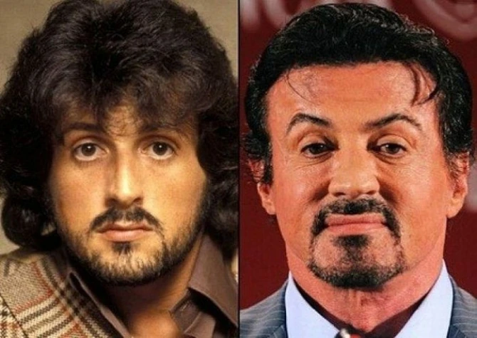 10 примеров неудачной пластики знаменитостей