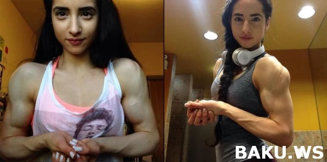 Anoreksiya xəstəsi olan qız qeyri-mümkün olanı bacardı (FOTO)