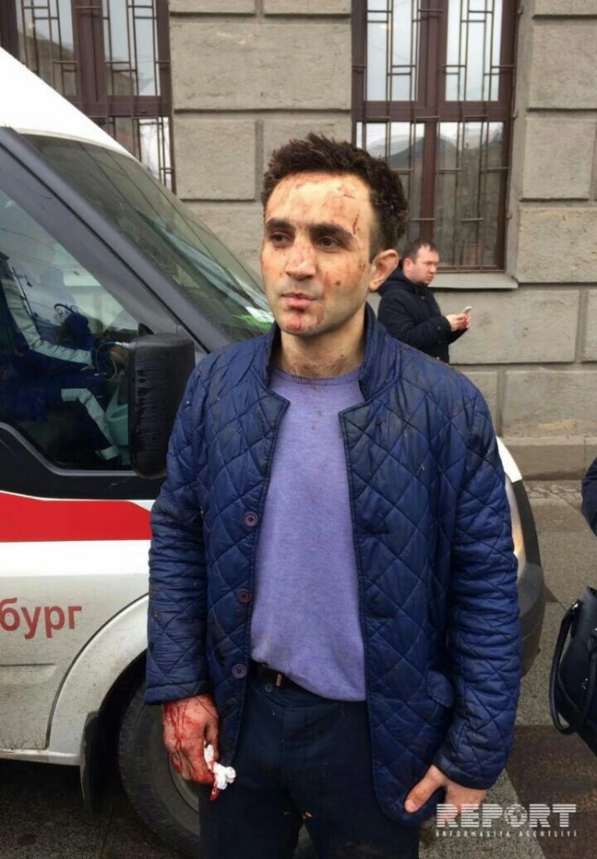Раненный в метро Санкт-Петербурга азербайджанец: Смертник стоял прямо рядом со мной (фото)