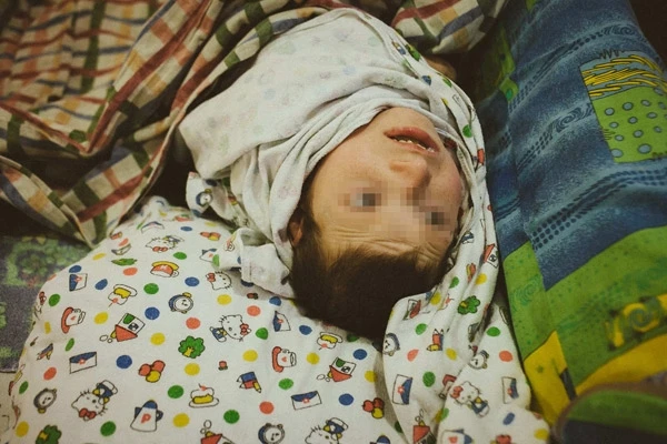Dünyanı şoka salan hadisə - 20 yaşındakı qız 11 kq çəkiyə düşdü (FOTO)