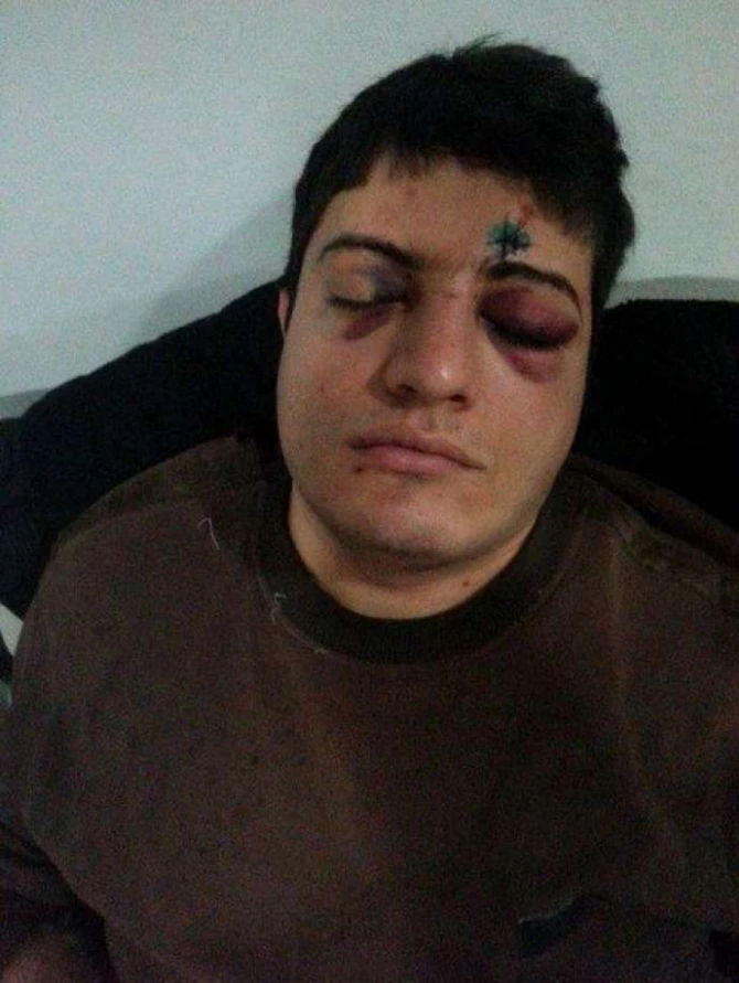 Eldar Mahmudovun kortejinin qabağını kəsdi və … - FOTO