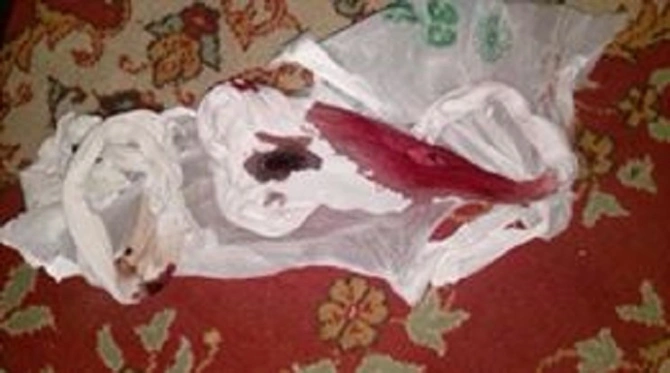 Azərbaycanda kişi arvadını çılpaq soyundurub bıçaqladı (FOTO)