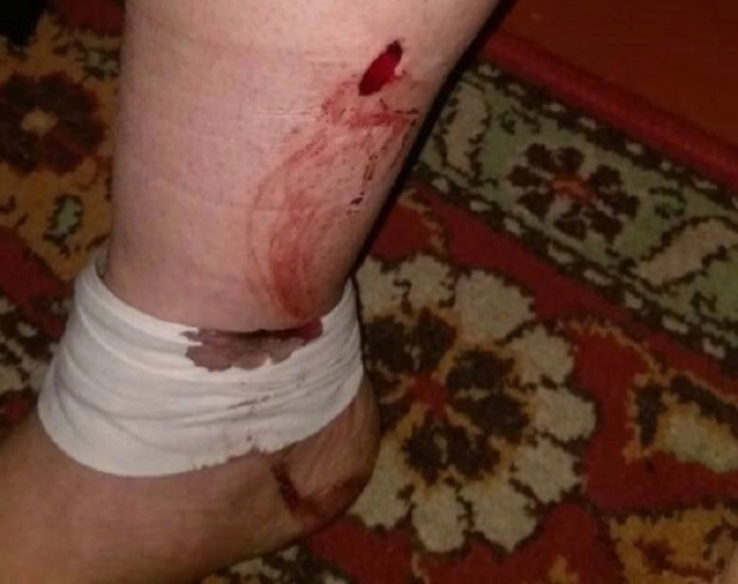 Azərbaycanda kişi arvadını çılpaq soyundurub bıçaqladı (FOTO)