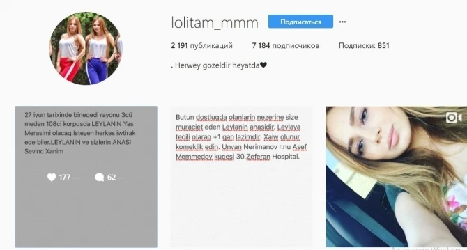 В Баку 22-летняя модель умерла во время пластической операции (видео)