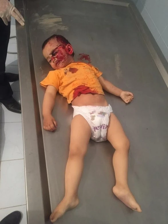 Sarkisyanın öldürdüyü Zəhranın nəşinin FOTOSU (18+)
