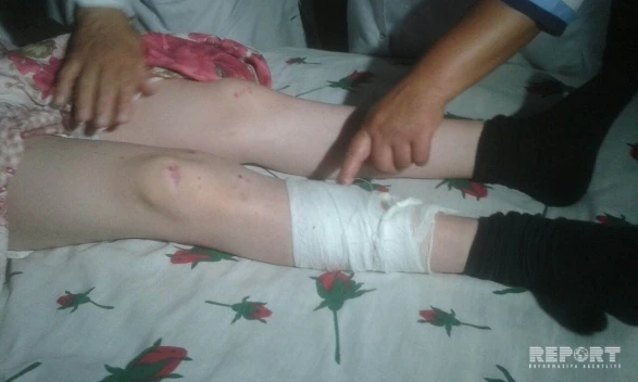 Армяне ранили 13-летнего азербайджанца (фото)