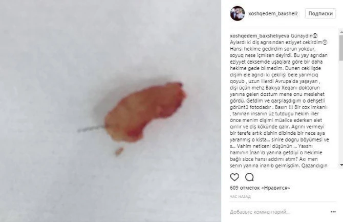 Xoşqədəm Hidayətqızı səriştəsiz həkimlərin qurbanı oldu (FOTO)